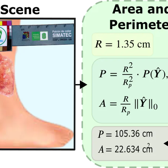 Automated Chronic Wounds Medical Assessment and Tracking Framework Based on Deep Learning